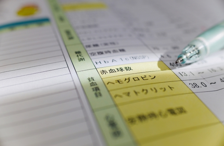 血流が悪くなると身体にどんな影響があるの？原因と改善法を解説！/池袋で慢性痛を改善するならreborn鍼灸整骨院