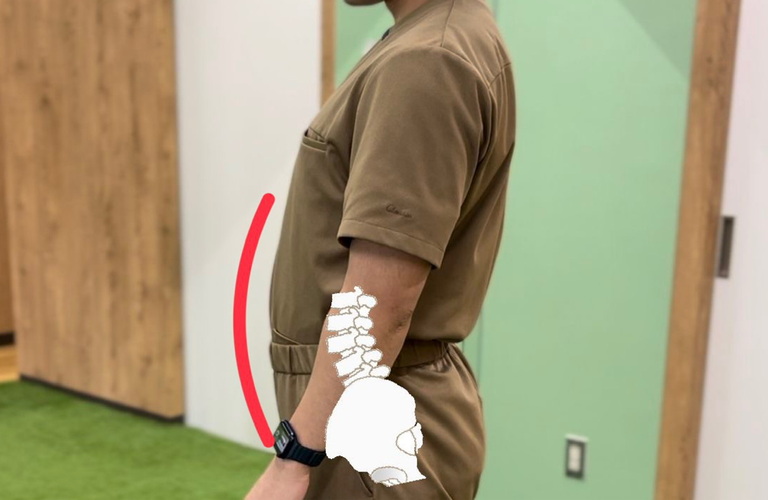 姿勢を伸ばそうとして胸を張るのは反り腰の原因！池袋で通わせない整骨院はreborn鍼灸整骨院